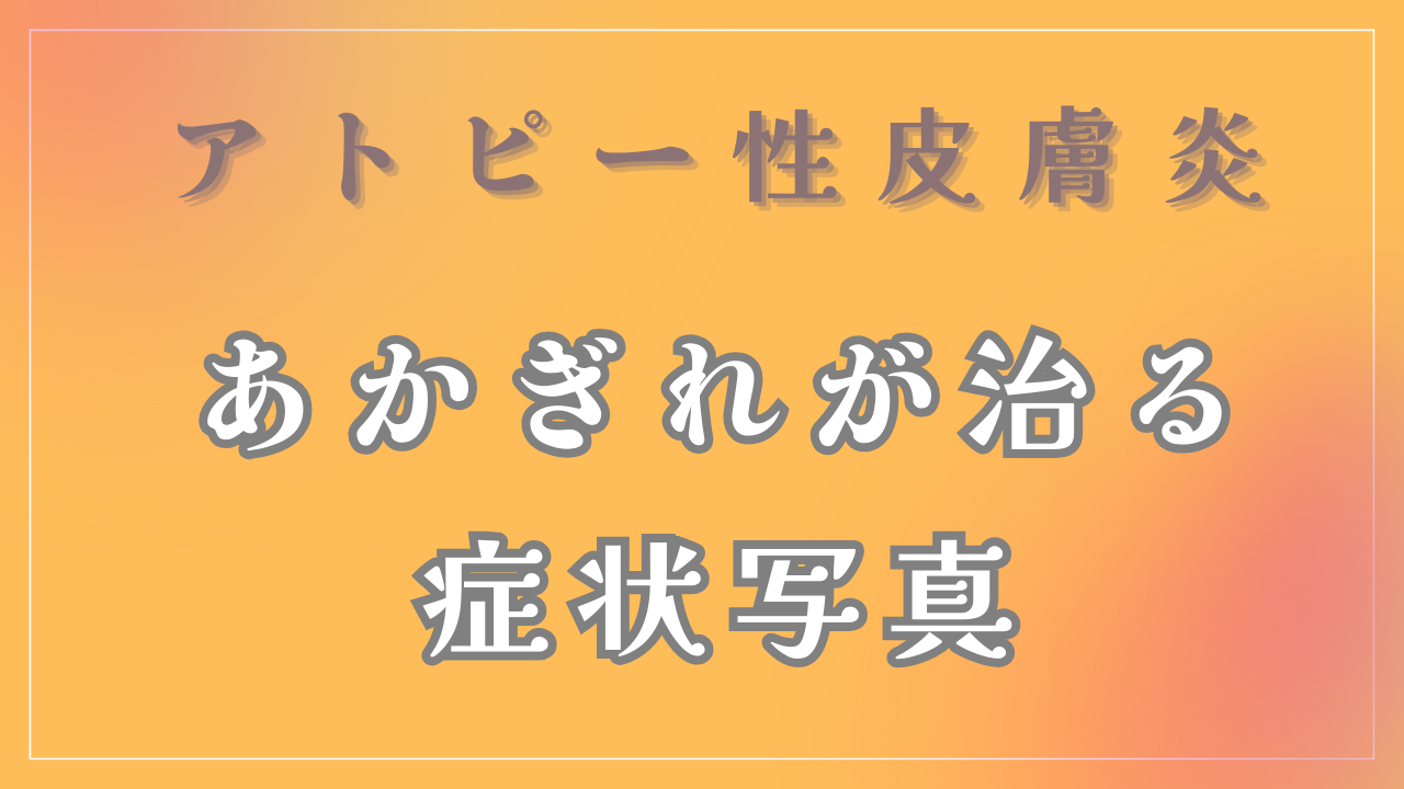 あかぎれが治る症状写真