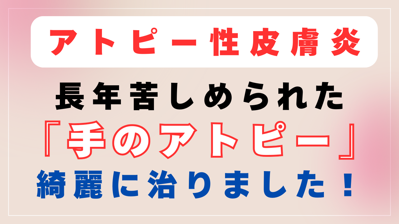 手のアトピーが完治しました。