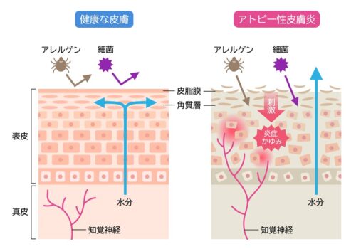 皮膚の断面