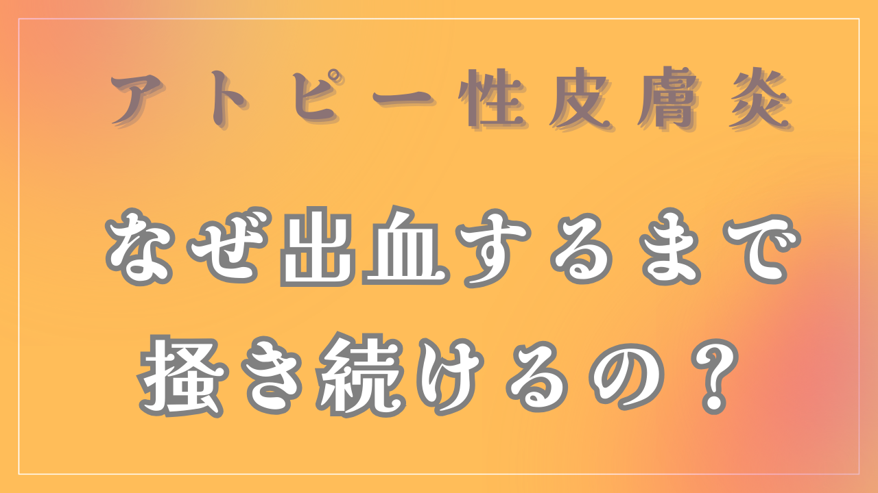 なぜアトピーになると出血するまで掻き続けるの？