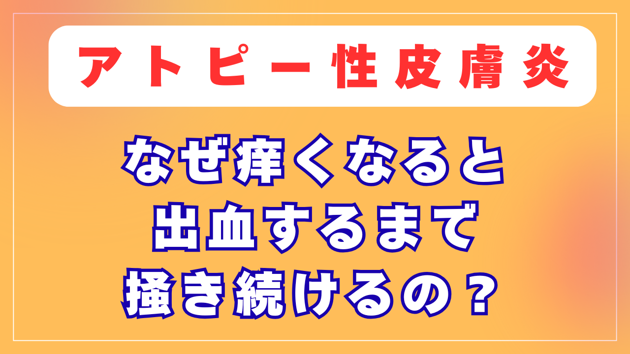 なぜアトピーになると出血するまで掻き続けるの？